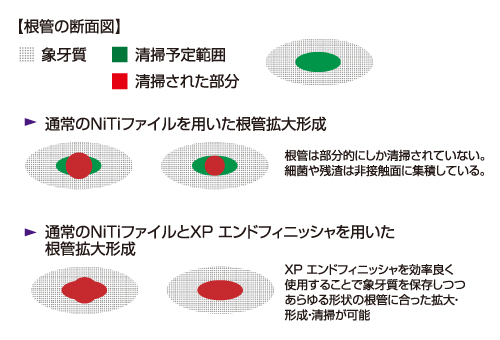 rc_treatment02